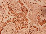 HSPE1 Antibody in Immunohistochemistry (Paraffin) (IHC (P))