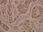 RPH3A Antibody in Immunohistochemistry (Paraffin) (IHC (P))