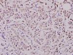 WAVE1 Antibody in Immunohistochemistry (Paraffin) (IHC (P))