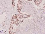 hnRNP D Antibody in Immunohistochemistry (Paraffin) (IHC (P))