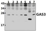 PMP22 Antibody in Western Blot (WB)