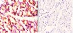 RAD52 Antibody in Immunohistochemistry (Paraffin) (IHC (P))