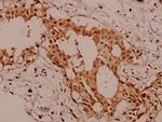 KSR1 Antibody in Immunohistochemistry (Paraffin) (IHC (P))