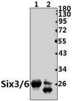 SIX3/SIX6 Antibody in Western Blot (WB)