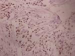 PRKAR1A Antibody in Immunohistochemistry (Paraffin) (IHC (P))