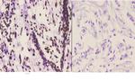 C/EBP delta/epsilon Antibody in Immunohistochemistry (Paraffin) (IHC (P))