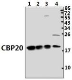 NCBP2 Antibody in Western Blot (WB)