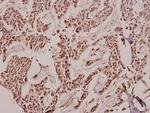 TCOF1 Antibody in Immunohistochemistry (Paraffin) (IHC (P))