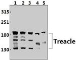 TCOF1 Antibody in Western Blot (WB)