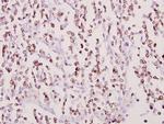 COX11 Antibody in Immunohistochemistry (Paraffin) (IHC (P))