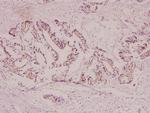 CYP21A2 Antibody in Immunohistochemistry (Paraffin) (IHC (P))