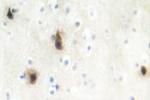 MVK Antibody in Immunohistochemistry (Paraffin) (IHC (P))