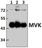 MVK Antibody in Western Blot (WB)