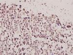 FOXE3 Antibody in Immunohistochemistry (Paraffin) (IHC (P))