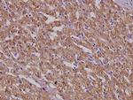 MSH3 Antibody in Immunohistochemistry (Paraffin) (IHC (P))