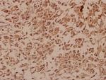 NAB2 Antibody in Immunohistochemistry (Paraffin) (IHC (P))