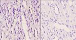 FZD10 Antibody in Immunohistochemistry (Paraffin) (IHC (P))