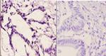 FZD10 Antibody in Immunohistochemistry (Paraffin) (IHC (P))