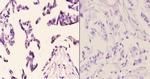 FZD10 Antibody in Immunohistochemistry (Paraffin) (IHC (P))