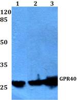 GPR40 Antibody in Western Blot (WB)