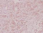 CXCL3 Antibody in Immunohistochemistry (Paraffin) (IHC (P))