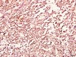 GABRB2 Antibody in Immunohistochemistry (Paraffin) (IHC (P))