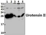 UTS2 Antibody in Western Blot (WB)