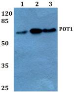 POT1 Antibody in Western Blot (WB)