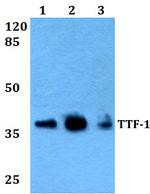 Nkx2.1 Antibody in Western Blot (WB)