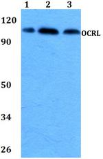 OCRL Antibody in Western Blot (WB)