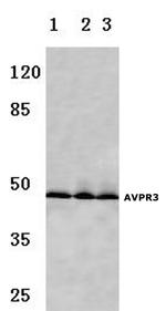 AVPR1B Antibody in Western Blot (WB)