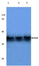 A4GNT Antibody in Western Blot (WB)