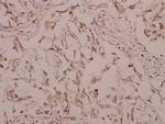 BMP-5 Antibody in Immunohistochemistry (Paraffin) (IHC (P))