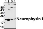 Oxytocin Antibody in Western Blot (WB)