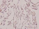 ATP5J2 Antibody in Immunohistochemistry (Paraffin) (IHC (P))