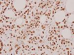 Cardiotrophin 1 Antibody in Immunohistochemistry (Paraffin) (IHC (P))