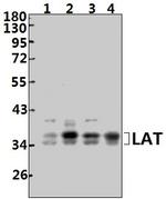 LAT Antibody in Western Blot (WB)