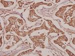 SLC25A6 Antibody in Immunohistochemistry (Paraffin) (IHC (P))