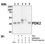 PDK2 Antibody in Immunoprecipitation (IP)