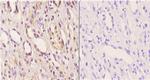 ABCD4 Antibody in Immunohistochemistry (Paraffin) (IHC (P))