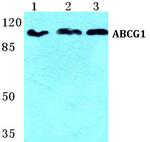 ABCG1 Antibody in Western Blot (WB)