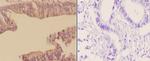 Arp3 Antibody in Immunohistochemistry (Paraffin) (IHC (P))