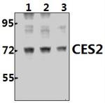 CES2 Antibody in Western Blot (WB)