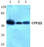 CYP2J2 Antibody in Western Blot (WB)