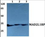 MAD2L1BP Antibody in Western Blot (WB)