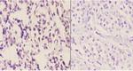 NDUFS1 Antibody in Immunohistochemistry (Paraffin) (IHC (P))