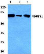 NDUFS1 Antibody in Western Blot (WB)