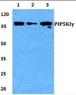 PIP5K1C Antibody in Western Blot (WB)