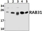 RAB31 Antibody in Western Blot (WB)