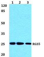 RGS5 Antibody in Western Blot (WB)